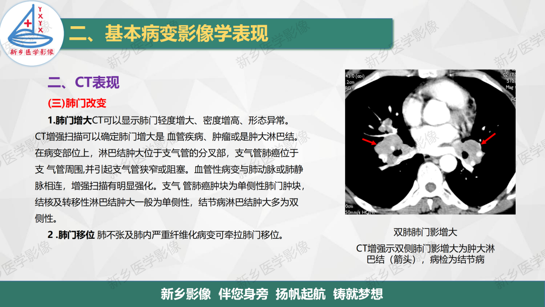 影像PPT - 【PPT】医学影像诊断学教材解读—呼吸基本病变影像表现3-17