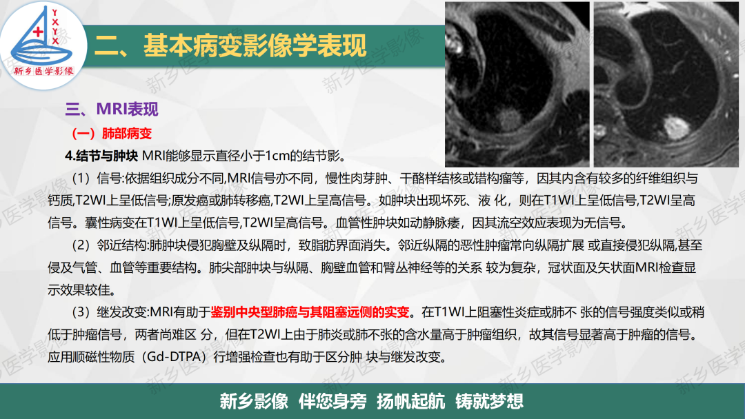 影像PPT - 【PPT】医学影像诊断学教材解读—呼吸基本病变影像表现3-24