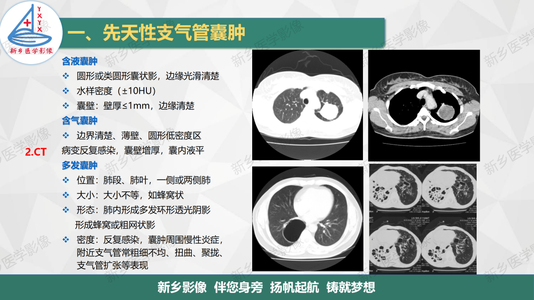 影像PPT - 【PPT】医学影像诊断学教材解读—气管和支气管病变-6