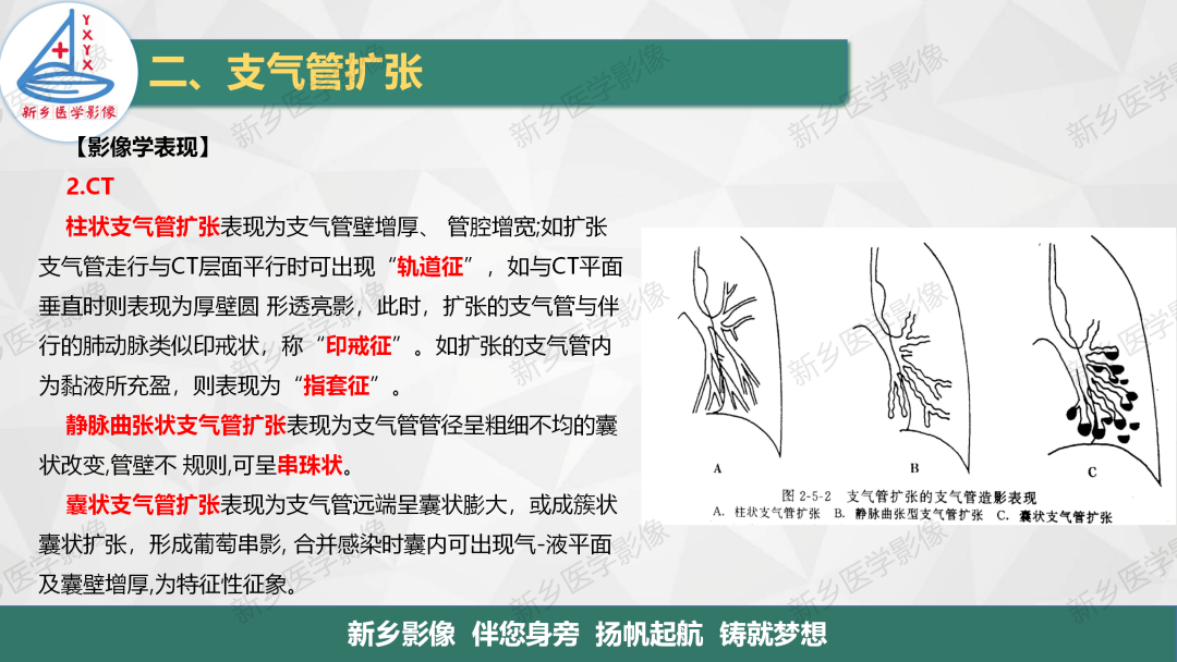 影像PPT - 【PPT】医学影像诊断学教材解读—气管和支气管病变-10