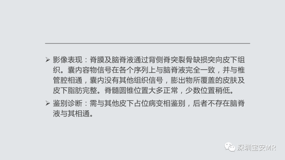 影像PPT - 【PPT】隐性神经管闭合不全的影像诊断-5