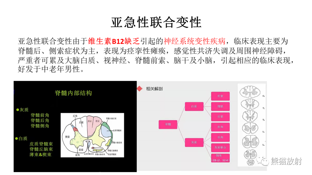 影像PPT - 【病例】脊髓亚急性联合变性2例MR-25