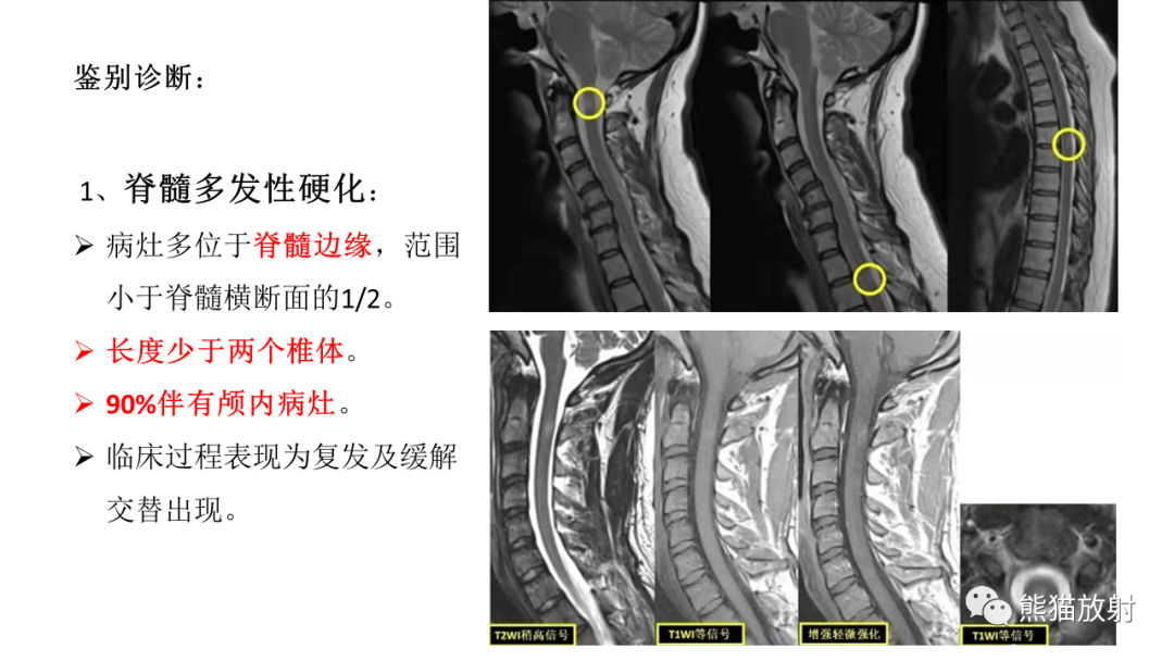 影像PPT - 【病例】脊髓亚急性联合变性2例MR-27