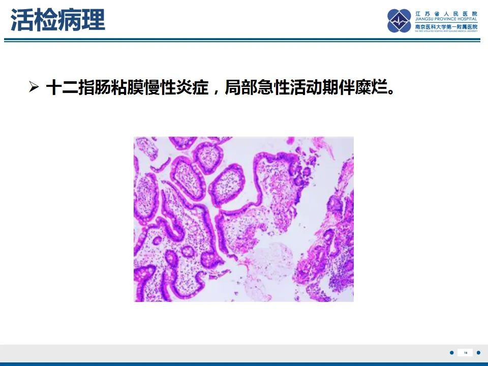 影像PPT - 【PPT】腹型过敏性紫癜-19