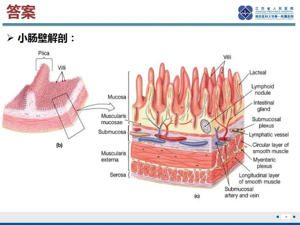 影像PPT - 【PPT】腹型过敏性紫癜-31
