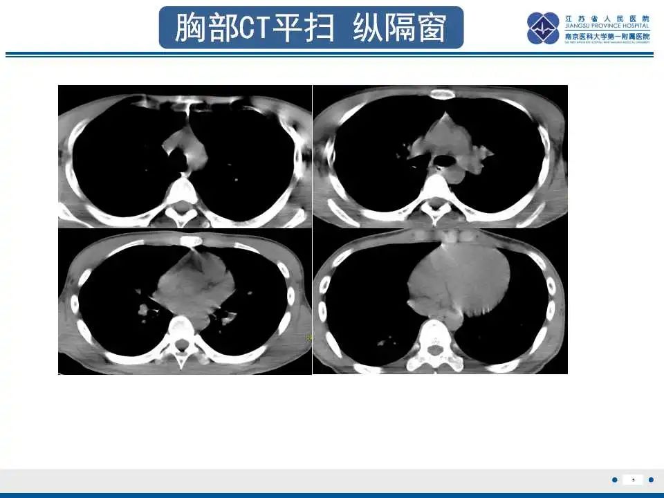影像PPT - 【PPT】虫螨腈中毒-6