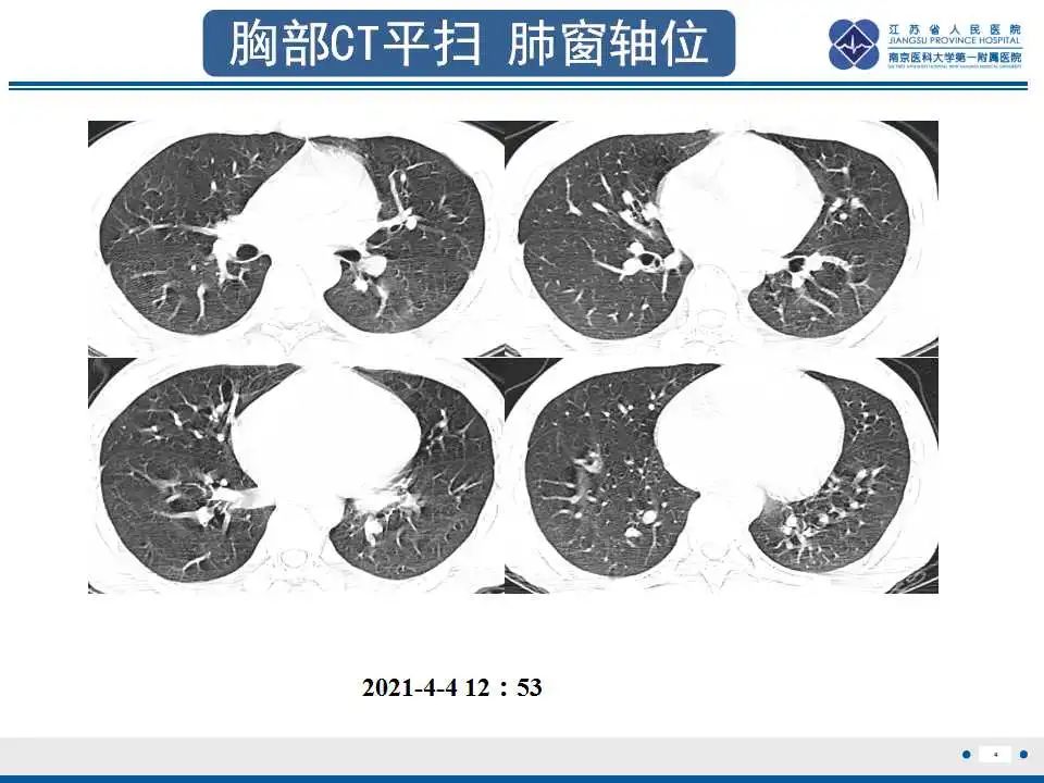 影像PPT - 【PPT】虫螨腈中毒-5