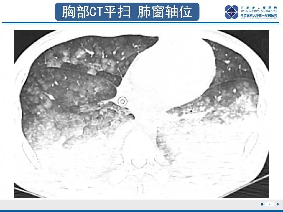影像PPT - 【PPT】虫螨腈中毒-9