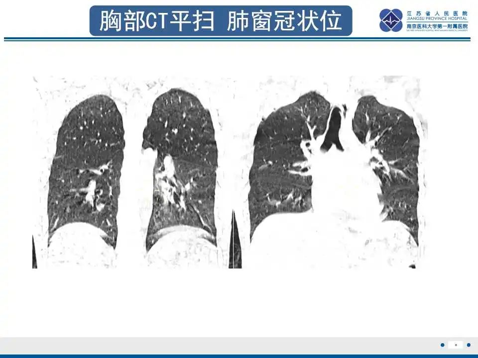 影像PPT - 【PPT】虫螨腈中毒-7