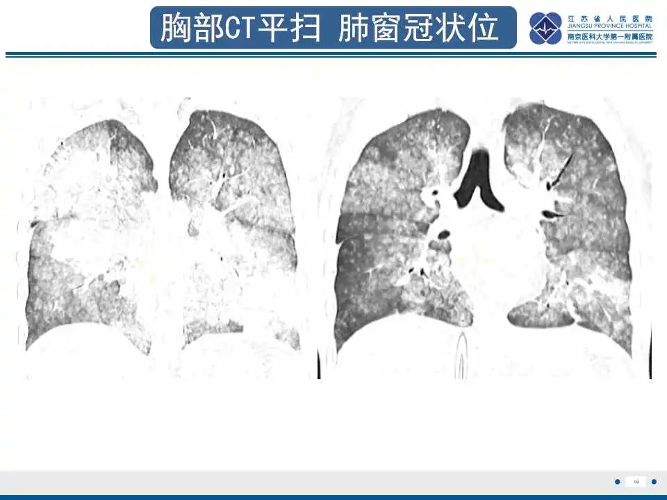 影像PPT - 【PPT】虫螨腈中毒-11