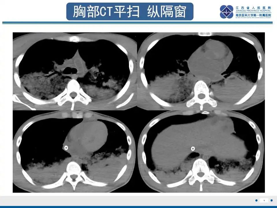 影像PPT - 【PPT】虫螨腈中毒-10