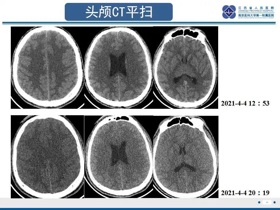 影像PPT - 【PPT】虫螨腈中毒-12
