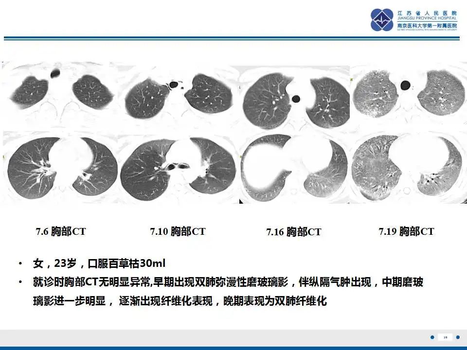 影像PPT - 【PPT】虫螨腈中毒-37