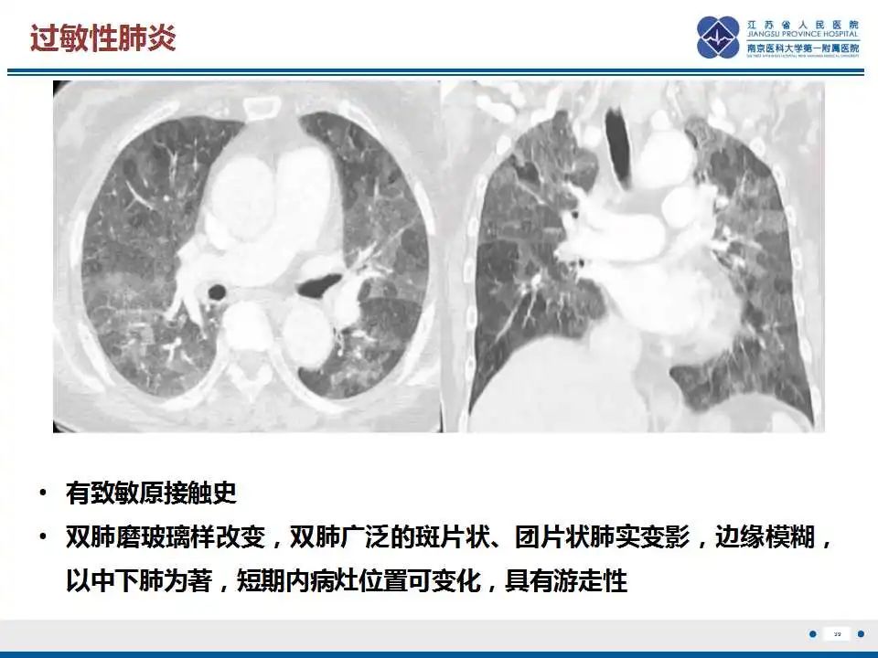 影像PPT - 【PPT】虫螨腈中毒-40