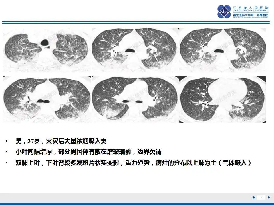 影像PPT - 【PPT】虫螨腈中毒-39