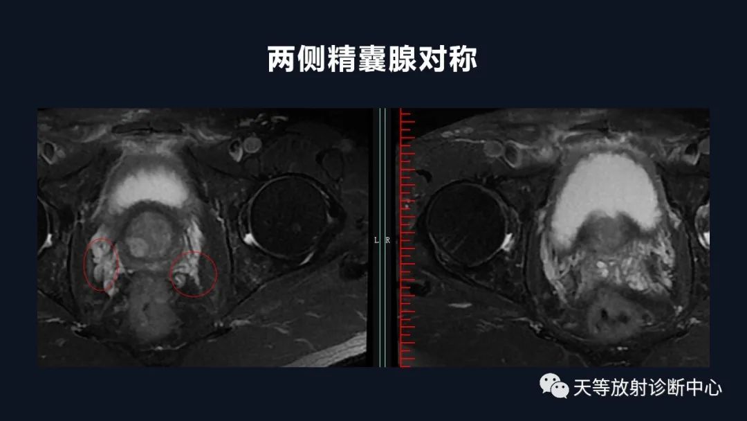影像PPT - 深度学习:前列腺增生与前列腺癌-10 影像PPT - 深度学习:前列腺增生与前列腺癌-10