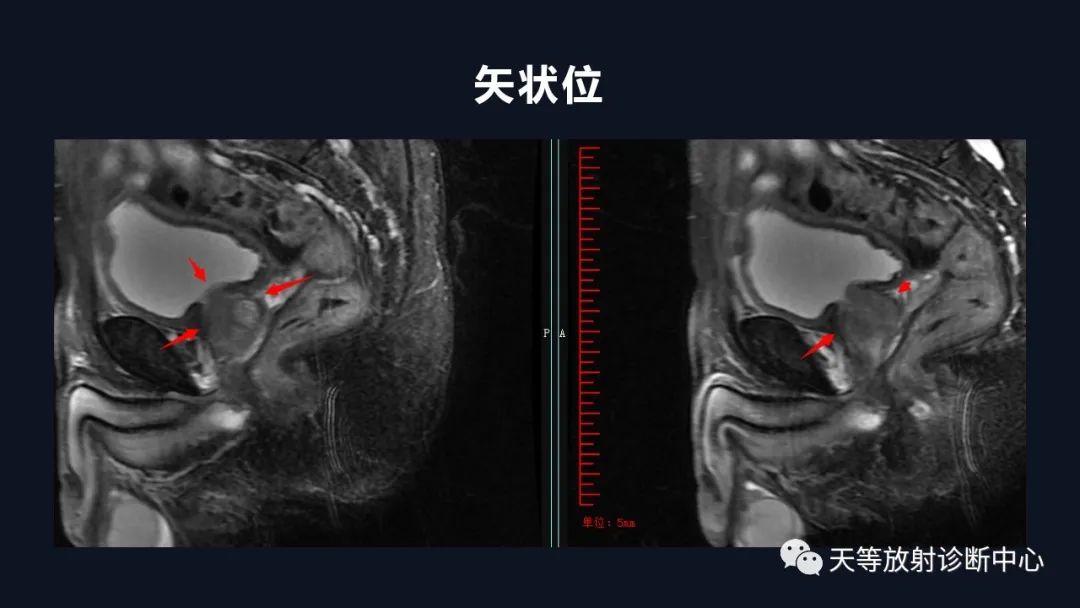 影像PPT - 深度学习:前列腺增生与前列腺癌-11 影像PPT - 深度学习:前列腺增生与前列腺癌-11