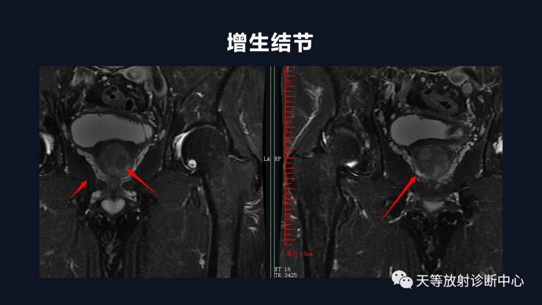 影像PPT - 深度学习:前列腺增生与前列腺癌-13 影像PPT - 深度学习:前列腺增生与前列腺癌-13