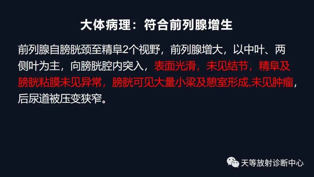 影像PPT - 深度学习:前列腺增生与前列腺癌-22 影像PPT - 深度学习:前列腺增生与前列腺癌-22