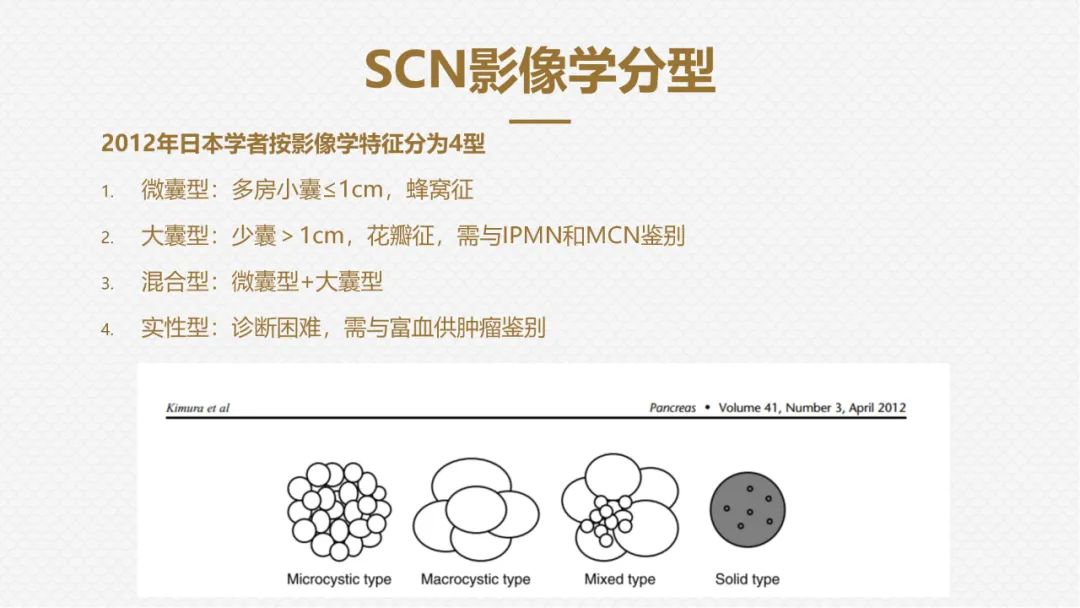 影像PPT - “囊外囊”征象可以特异性诊断“胰腺寡囊型浆液性囊腺瘤”(SCN)-20 影像PPT - “囊外囊”征象可以特异性诊断“胰腺寡囊型浆液性囊腺瘤”(SCN)-20