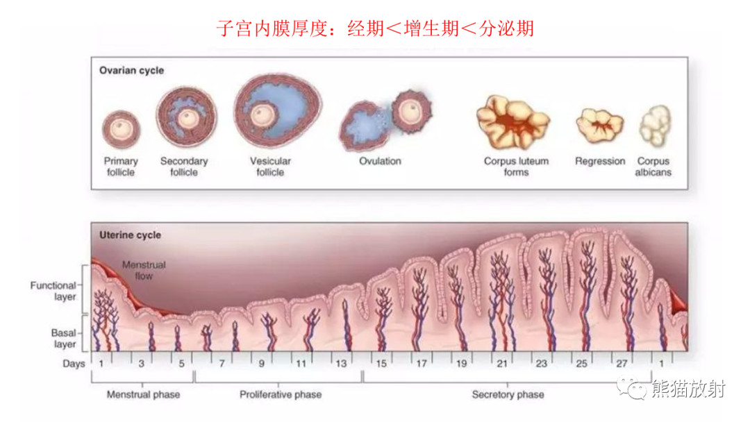影像PPT - 【病例】子宫内膜息肉样增生 VS 子宫内膜癌 MR-28