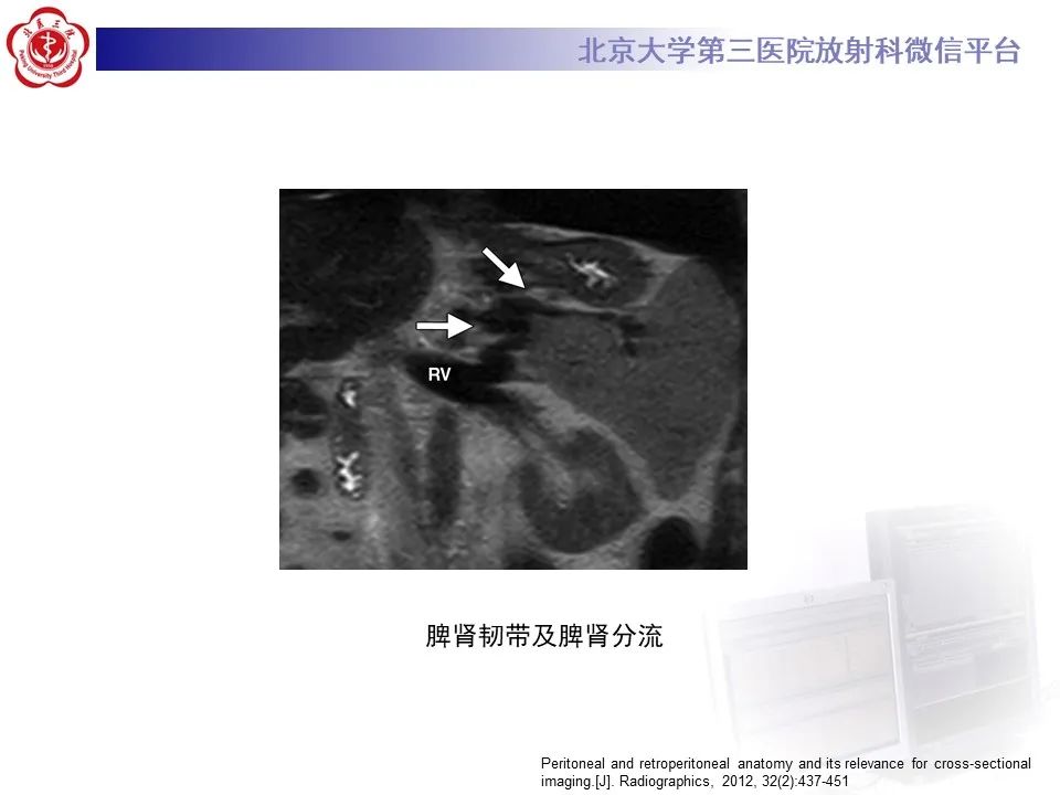 影像PPT - 【PPT】腹膜及腹膜后解剖及影像-12