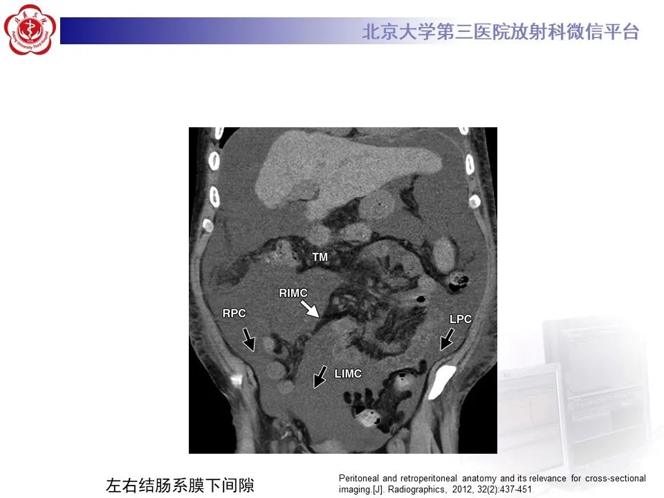 影像PPT - 【PPT】腹膜及腹膜后解剖及影像-23