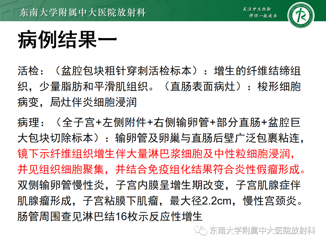 影像PPT - 【PPT】妇科疑难病例讨论3例-10 影像PPT - 【PPT】妇科疑难病例讨论3例-10