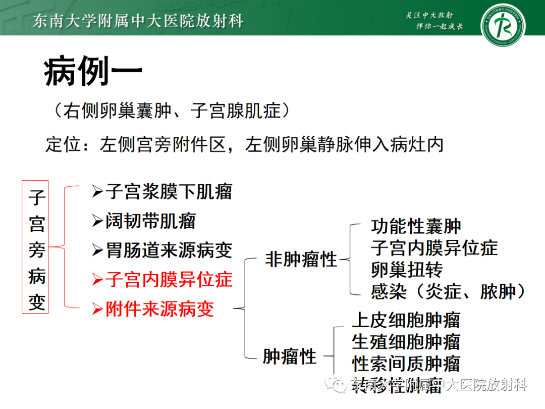 影像PPT - 【PPT】妇科疑难病例讨论3例-12 影像PPT - 【PPT】妇科疑难病例讨论3例-12