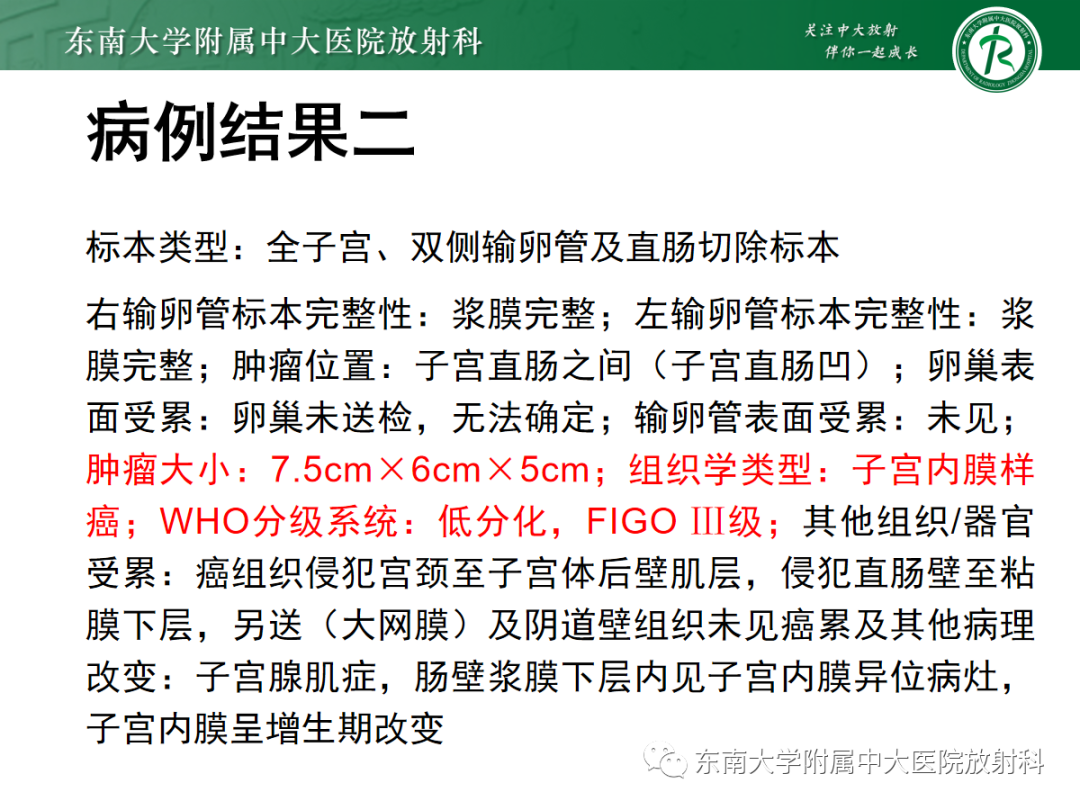 影像PPT - 【PPT】妇科疑难病例讨论3例-21 影像PPT - 【PPT】妇科疑难病例讨论3例-21
