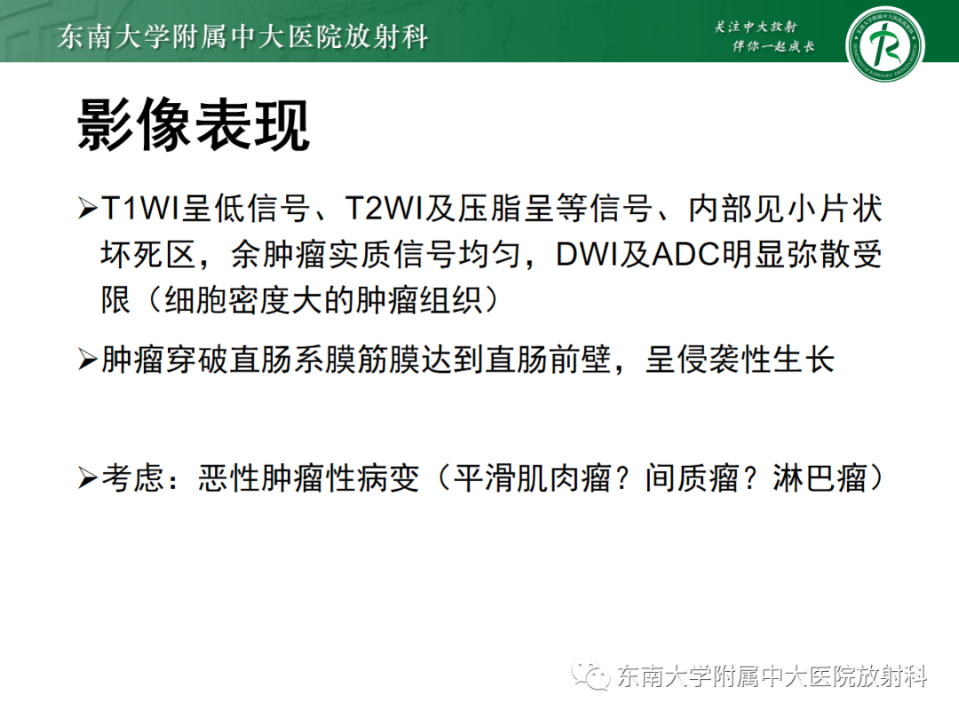 影像PPT - 【PPT】妇科疑难病例讨论3例-24 影像PPT - 【PPT】妇科疑难病例讨论3例-24