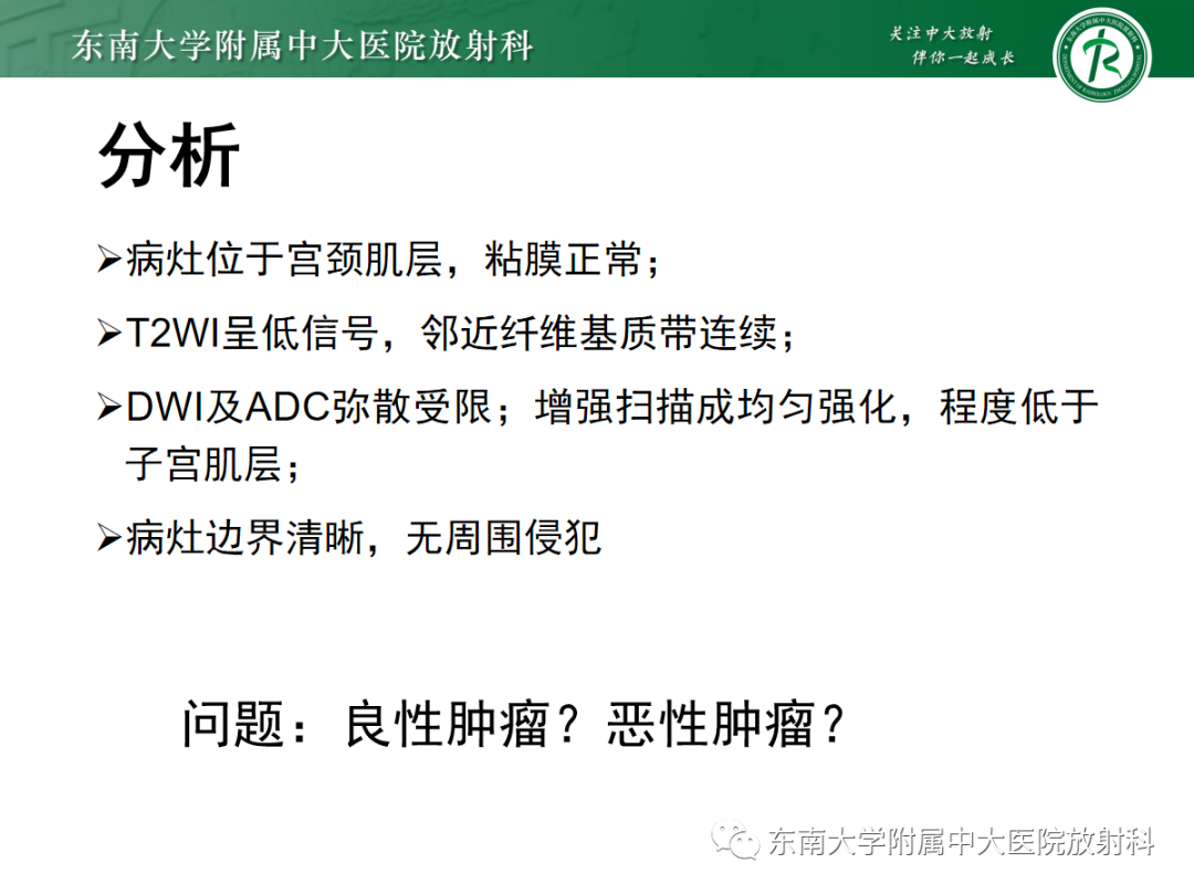 影像PPT - 【PPT】妇科疑难病例讨论3例-28 影像PPT - 【PPT】妇科疑难病例讨论3例-28