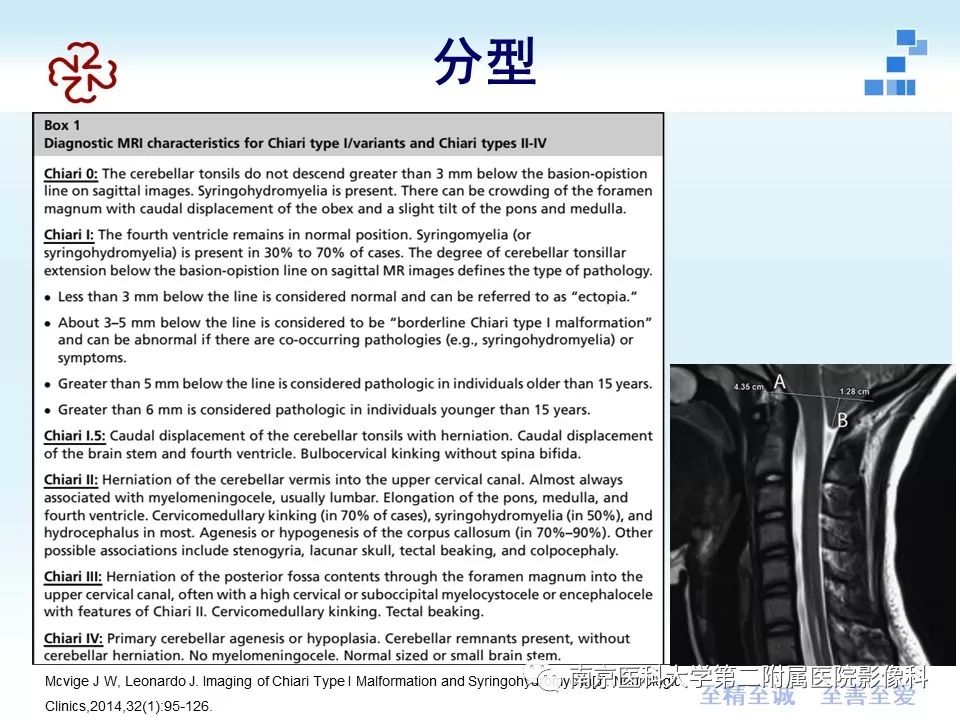 影像PPT - 【PPT】小脑扁桃体下疝畸形-8