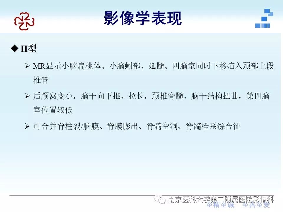 影像PPT - 【PPT】小脑扁桃体下疝畸形-17