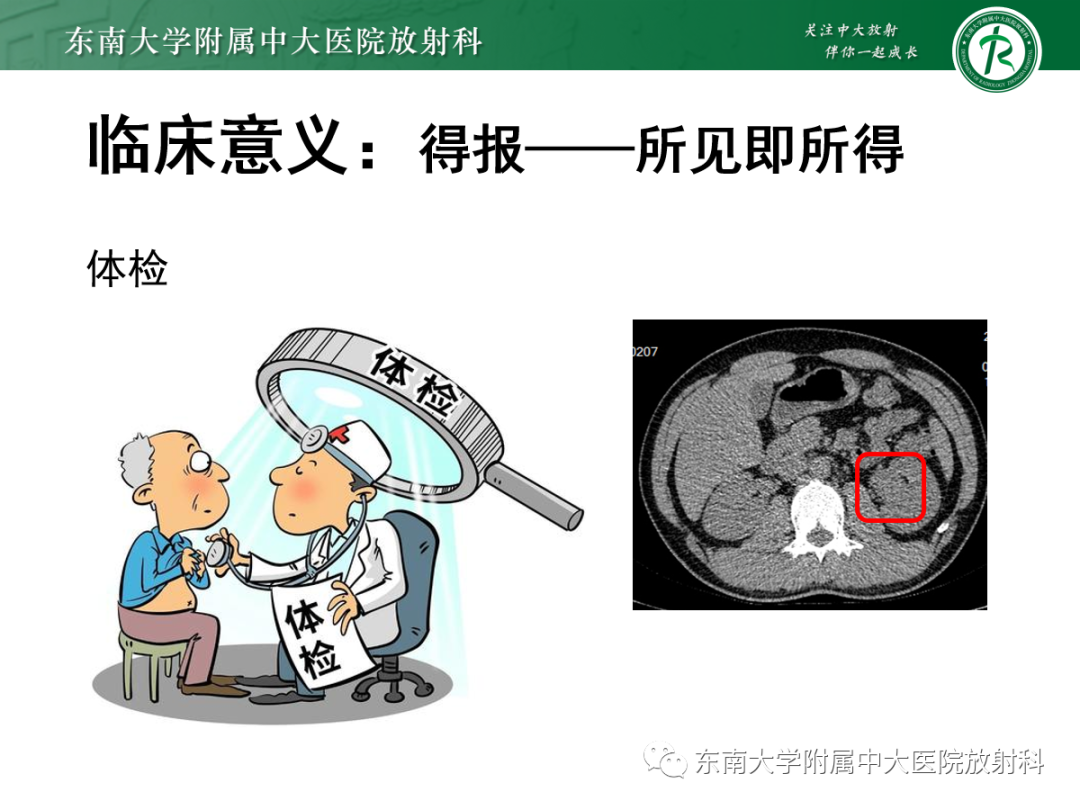 影像PPT - 【PPT】肾盂癌—Baron分型-18 影像PPT - 【PPT】肾盂癌—Baron分型-18