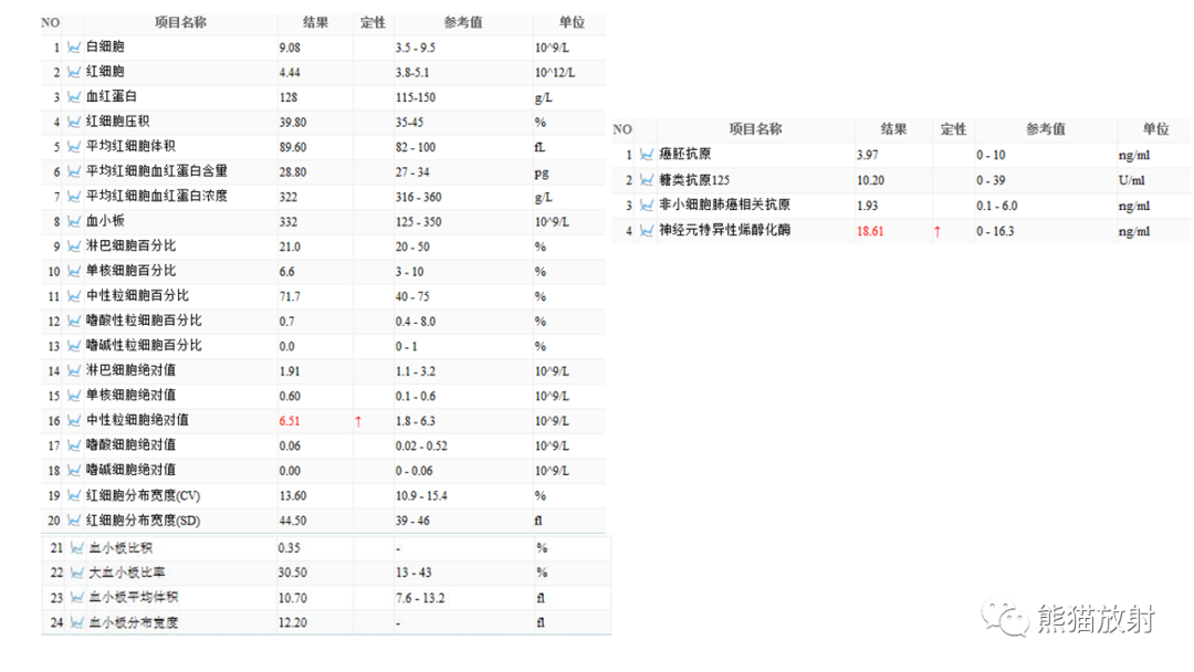影像PPT - 【PPT】肺类癌2例CT影像-3