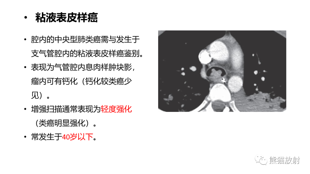 影像PPT - 【PPT】肺类癌2例CT影像-38