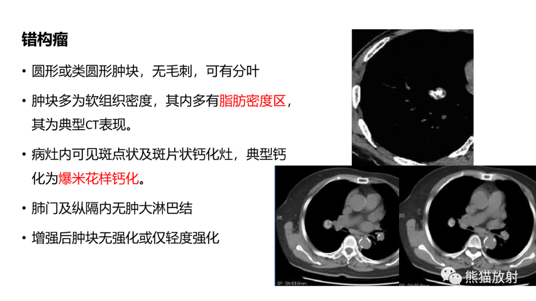 影像PPT - 【PPT】肺类癌2例CT影像-39