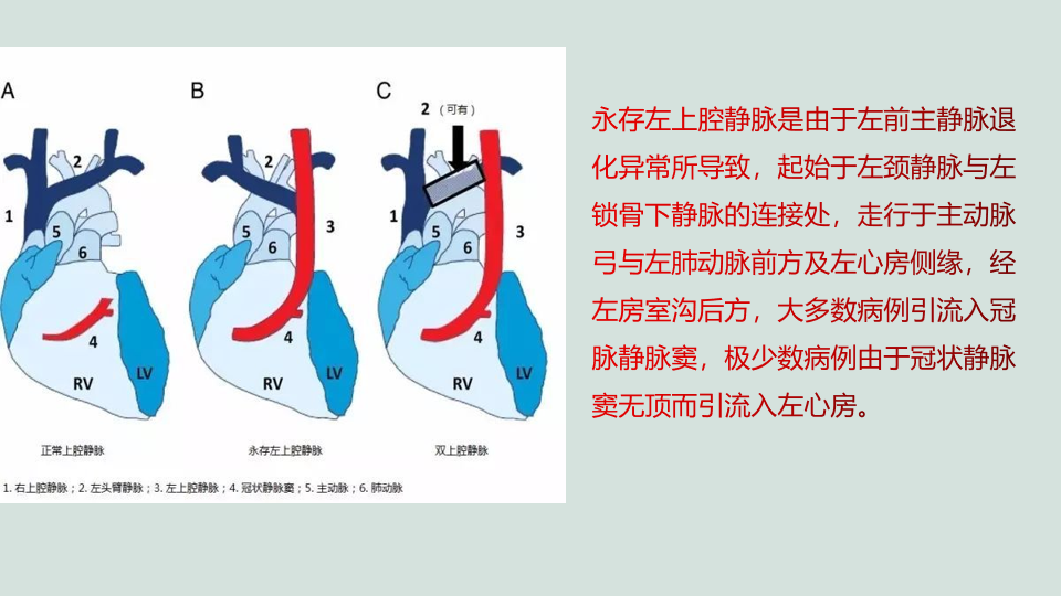 影像PPT - 【PPT】永存左上腔静脉 PLSVC-5