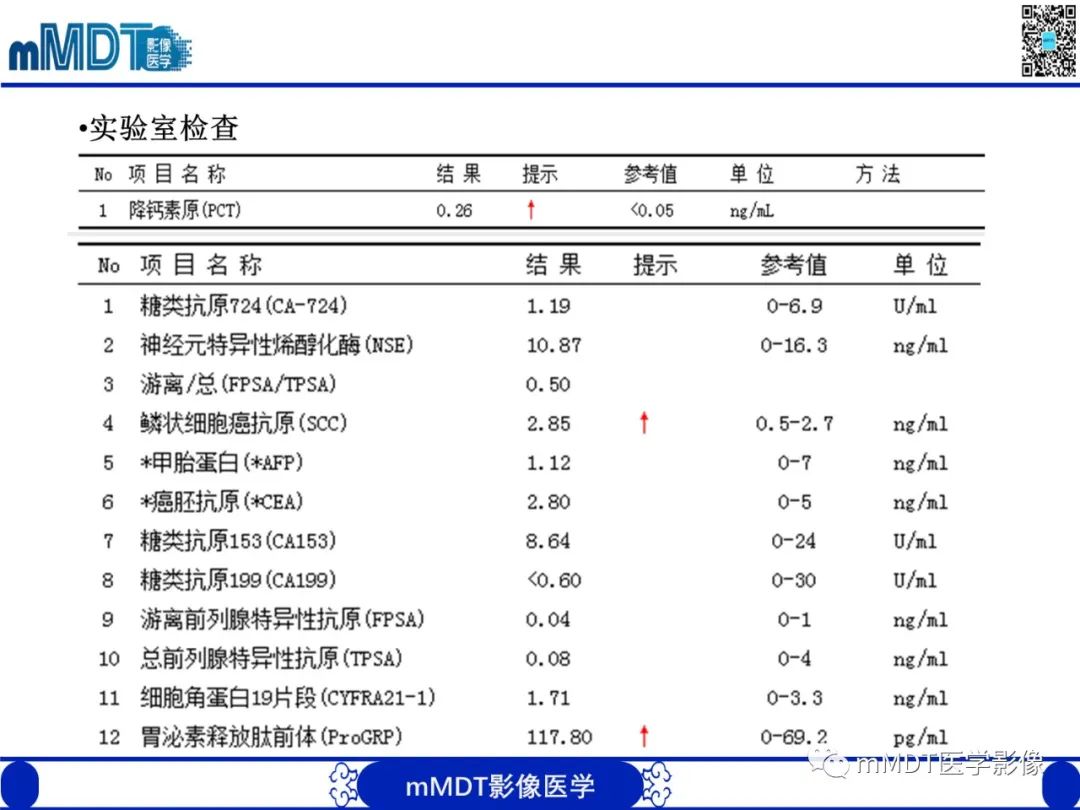 影像PPT - 【PPT】嗜酸粒细胞增多综合征-3 影像PPT - 【PPT】嗜酸粒细胞增多综合征-3
