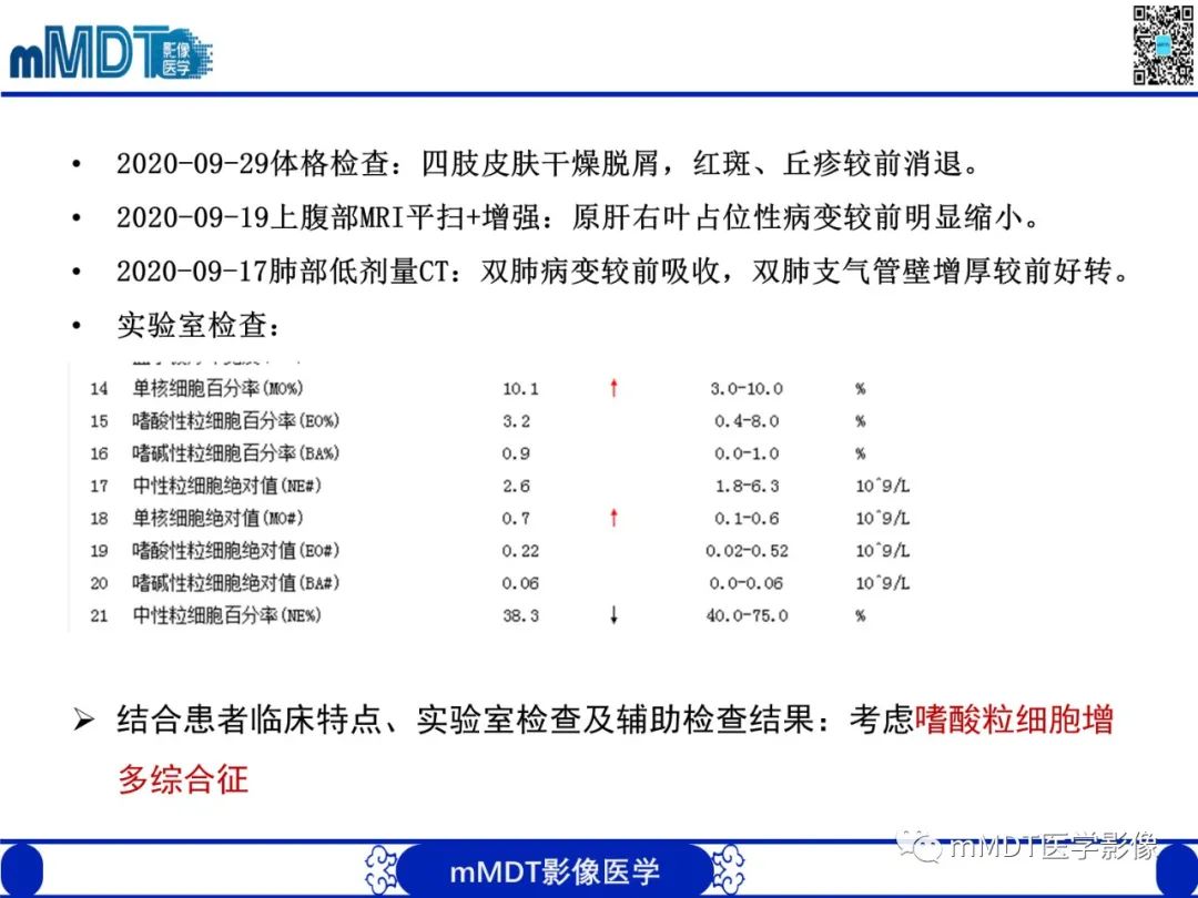 影像PPT - 【PPT】嗜酸粒细胞增多综合征-11 影像PPT - 【PPT】嗜酸粒细胞增多综合征-11