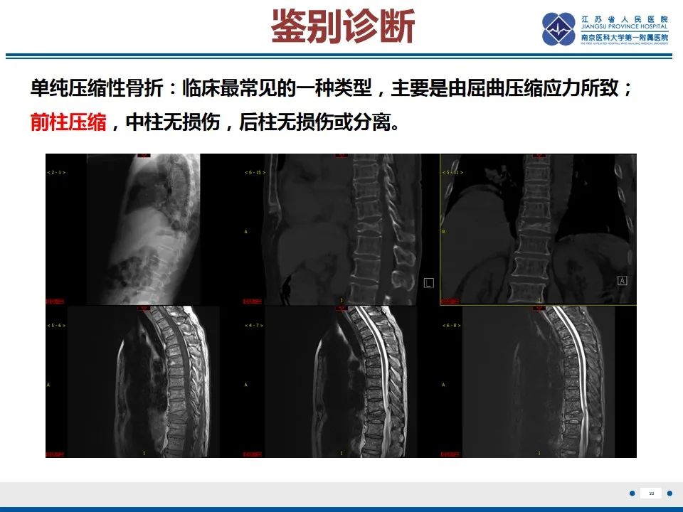 影像PPT - 【PPT】脊柱爆裂性骨折-34