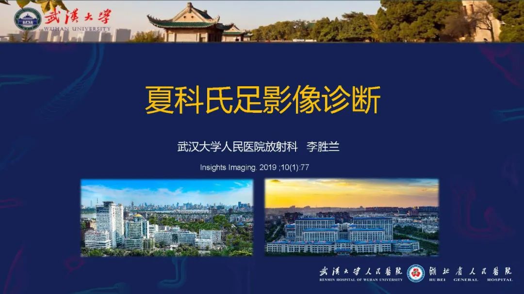 影像PPT - 【PPT】夏科氏足影像诊断-1