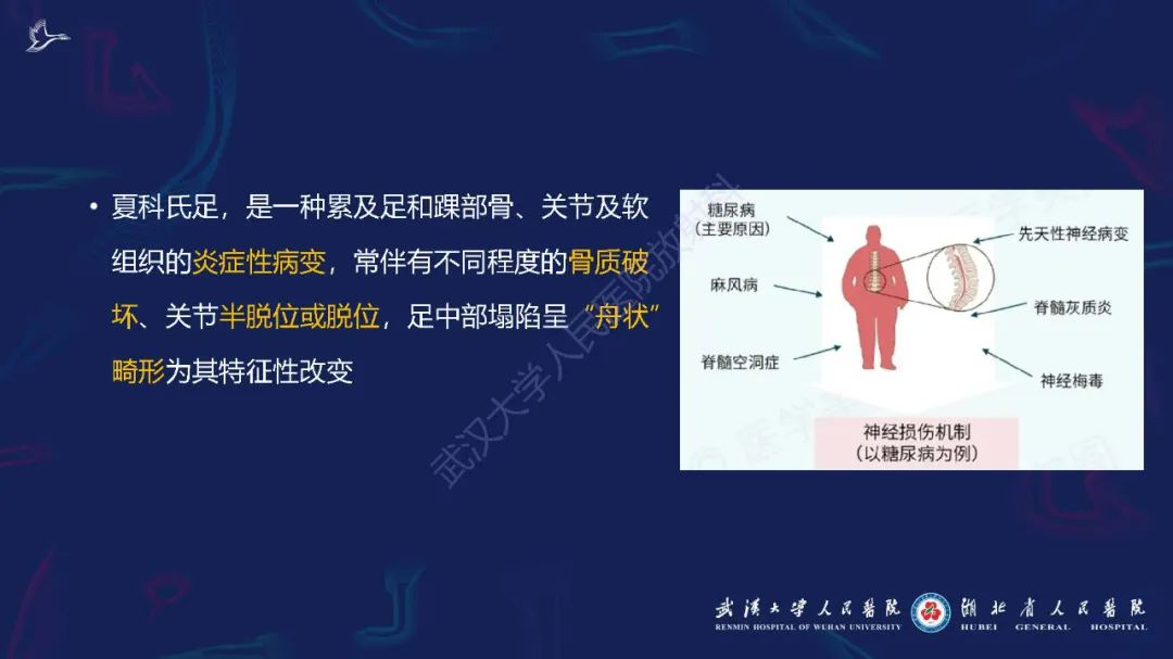 影像PPT - 【PPT】夏科氏足影像诊断-3