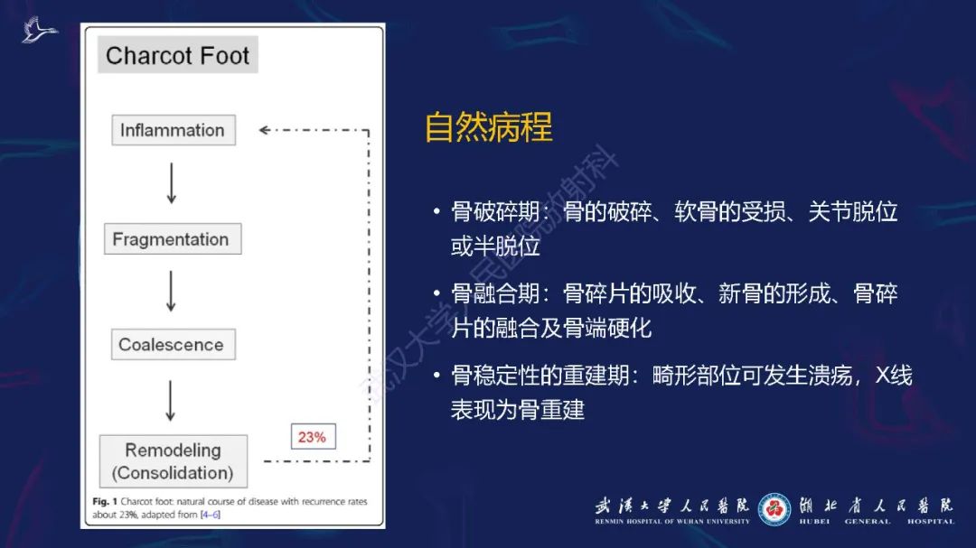 影像PPT - 【PPT】夏科氏足影像诊断-5