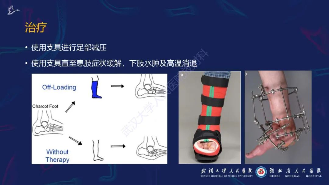 影像PPT - 【PPT】夏科氏足影像诊断-7