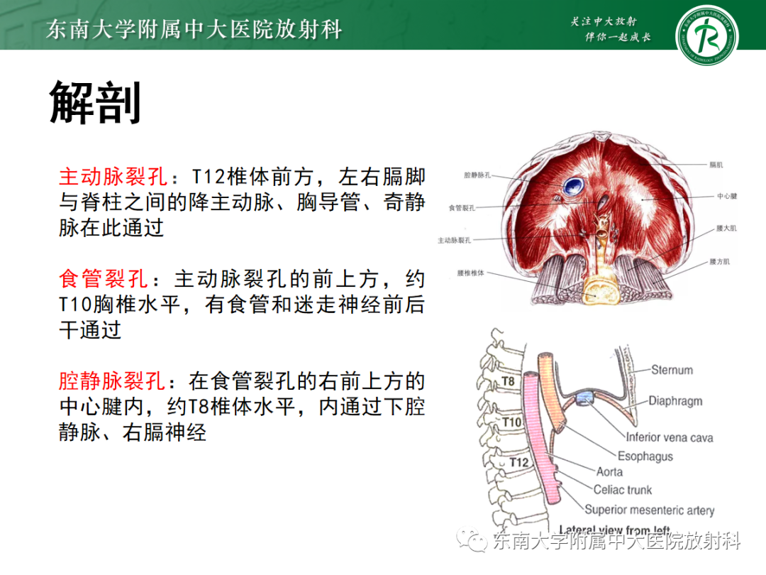 影像PPT - 【PPT】膈肌相关病变-5