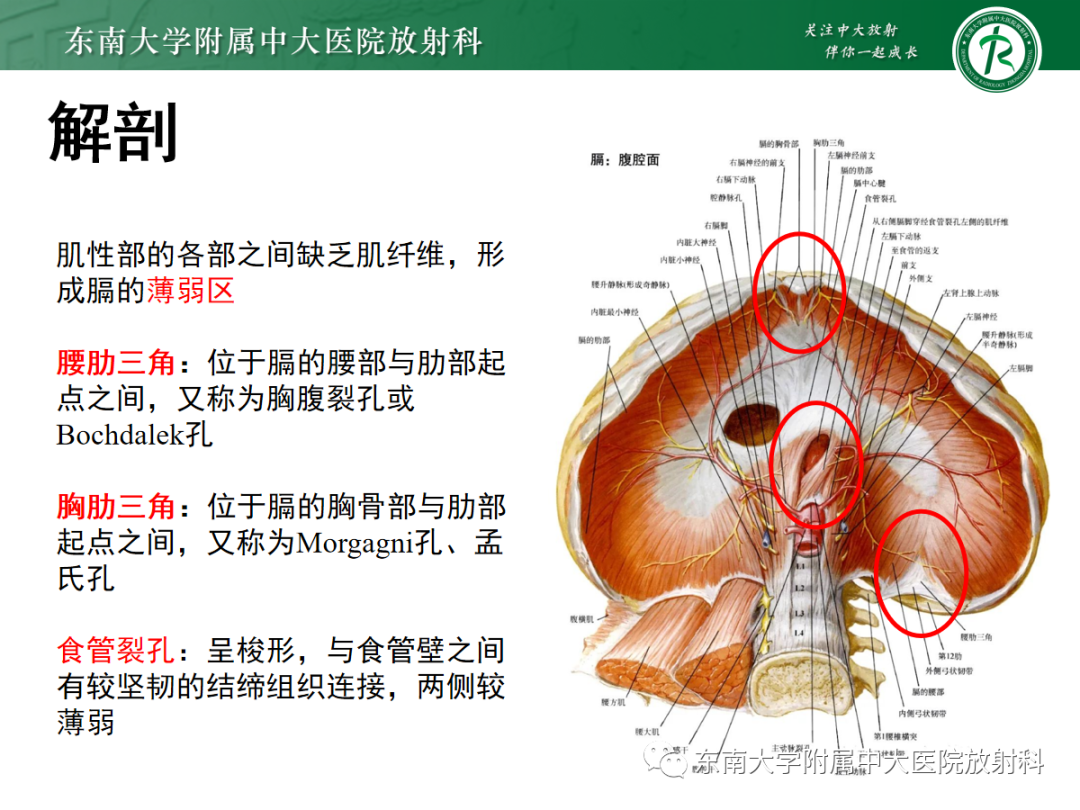 影像PPT - 【PPT】膈肌相关病变-4