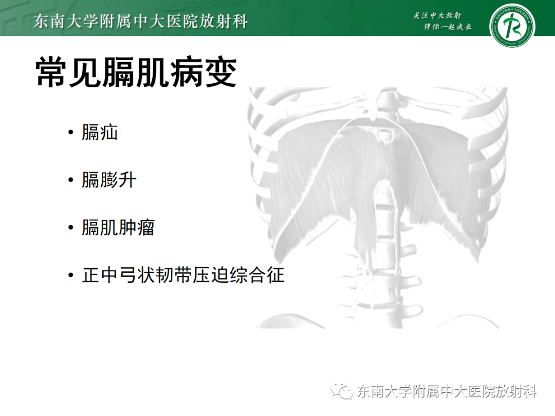 影像PPT - 【PPT】膈肌相关病变-8