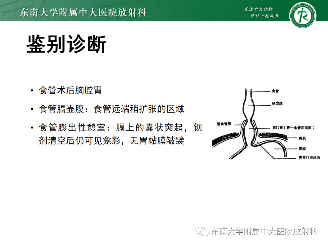 影像PPT - 【PPT】膈肌相关病变-16
